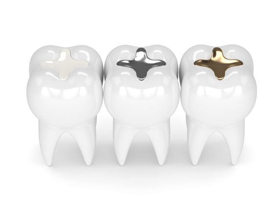 Who Is A Good Candidate For Dental Fillings.jpg